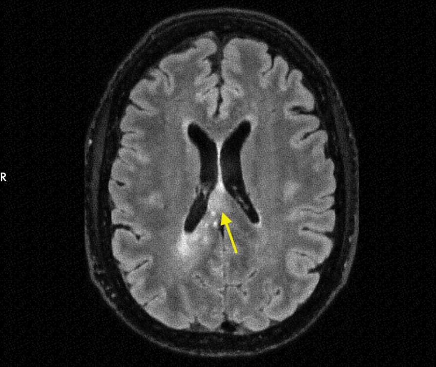 MRI from May 13