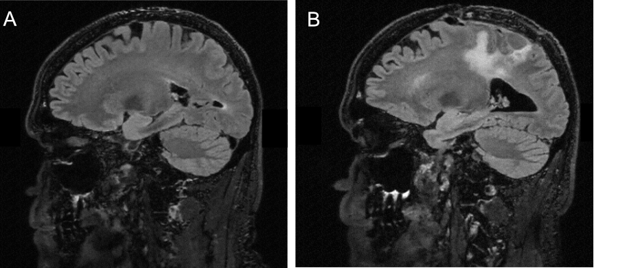 MRI from May 13